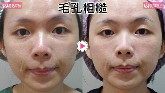 Yanjing Clinic-Aesthetic Medicine-Outpatient Clinic-Doctor-Taoyuan10101 Yanjing Clinic Aesthetic Medicine Outpatient Clinic Doctor Taoyuan10101 1024x576