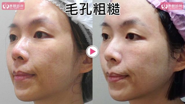 Yanjing Clinic-Aesthetic Medicine-Outpatient Clinic-Doctor-Taoyuan10102 Yanjing Clinic Aesthetic Medicine Outpatient Clinic Doctor Taoyuan10102 1024x576