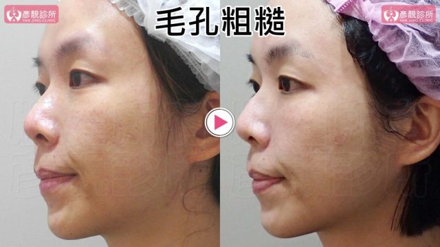 Yanjing Clinic-Aesthetic Medicine-Outpatient Clinic-Doctor-Taoyuan10103 Yanjing Clinic Aesthetic Medicine Outpatient Clinic Doctor Taoyuan10103 1024x576