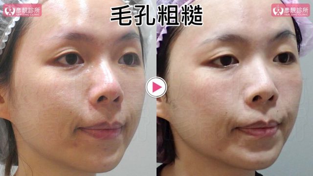 Yanjing Clinic-Aesthetic Medicine-Outpatient Clinic-Doctor-Taoyuan10104 Yanjing Clinic Aesthetic Medicine Outpatient Clinic Doctor Taoyuan10104 1024x576