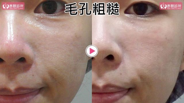 Yanjing Clinic-Aesthetic Medicine-Outpatient Clinic-Doctor-Taoyuan10105 Yanjing Clinic Aesthetic Medicine Outpatient Clinic Doctor Taoyuan10105 1024x576