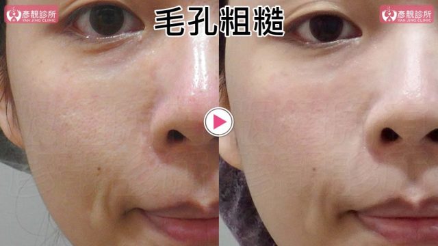Yanjing Clinic-Aesthetic Medicine-Outpatient Clinic-Doctor-Taoyuan10106 Yanjing Clinic Aesthetic Medicine Outpatient Clinic Doctor Taoyuan10106 1024x576