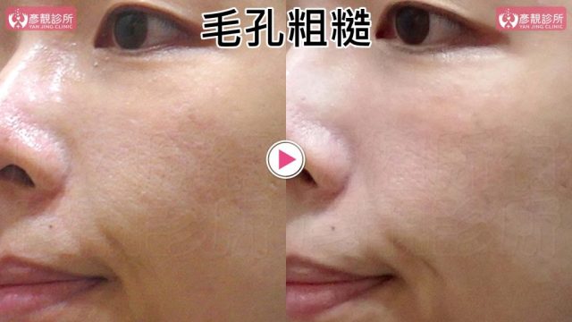 Yanjing Clinic-Aesthetic Medicine-Outpatient Clinic-Doctor-Taoyuan10107 Yanjing Clinic Aesthetic Medicine Outpatient Clinic Doctor Taoyuan10107 1024x576