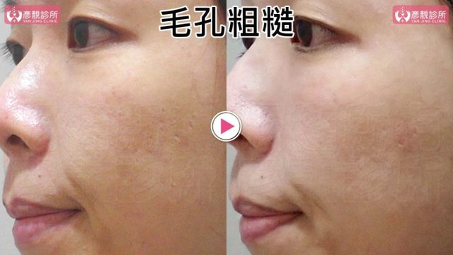 Yanjing Clinic-Aesthetic Medicine-Outpatient Clinic-Doctor-Taoyuan10108 Yanjing Clinic Aesthetic Medicine Outpatient Clinic Doctor Taoyuan10108 1024x576