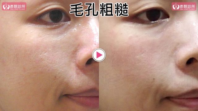 Yanjing Clinic-Aesthetic Medicine-Outpatient Clinic-Doctor-Taoyuan10109 Yanjing Clinic Aesthetic Medicine Outpatient Clinic Doctor Taoyuan10109 1024x576