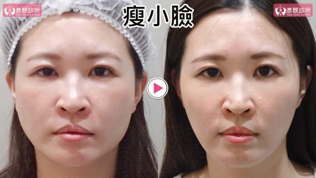 小臉01修 1024x576