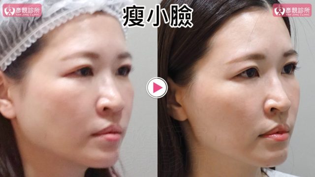 小臉03修 1024x576