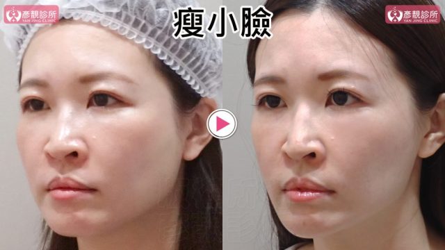 小臉05修 1024x576