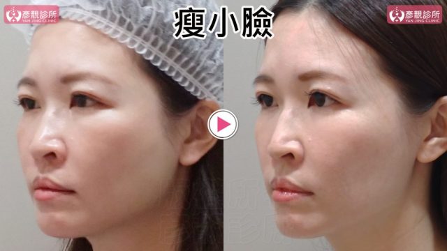 小臉06修 1024x576