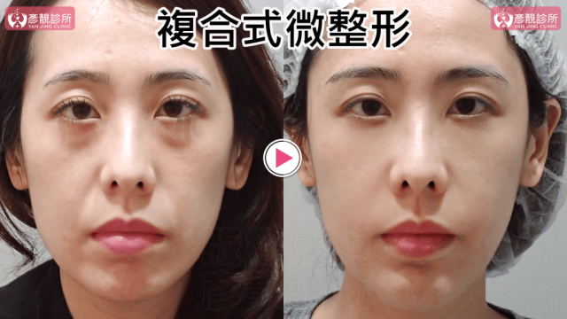 複合式微整形027