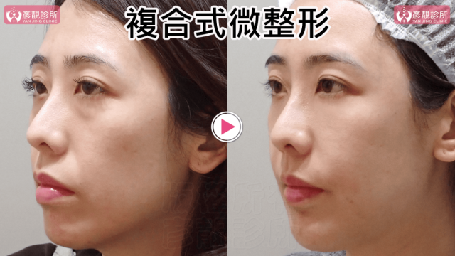 複合式微整形031