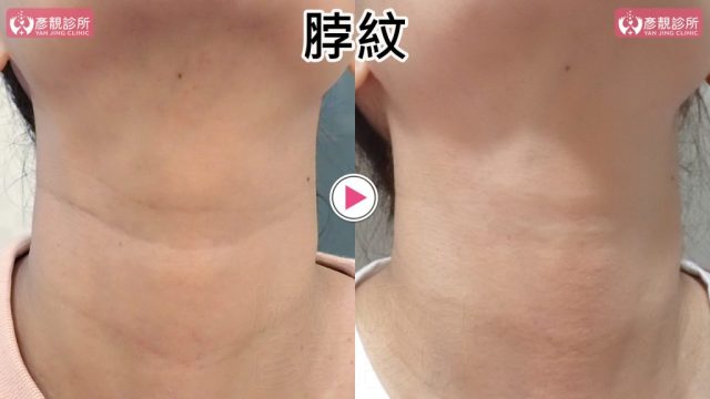 修脖紋 1 1024x576