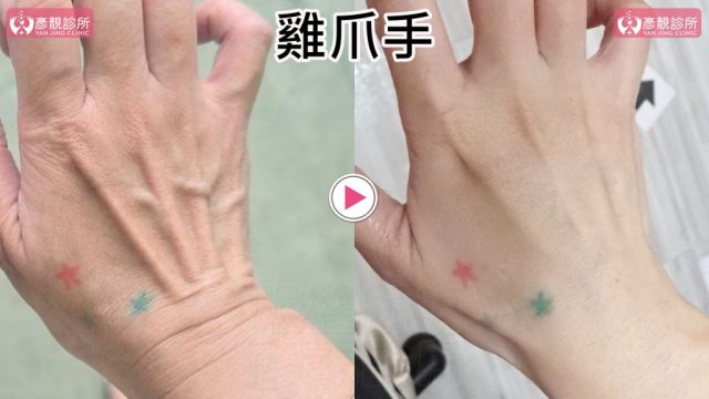 雞爪手 2 1024x576